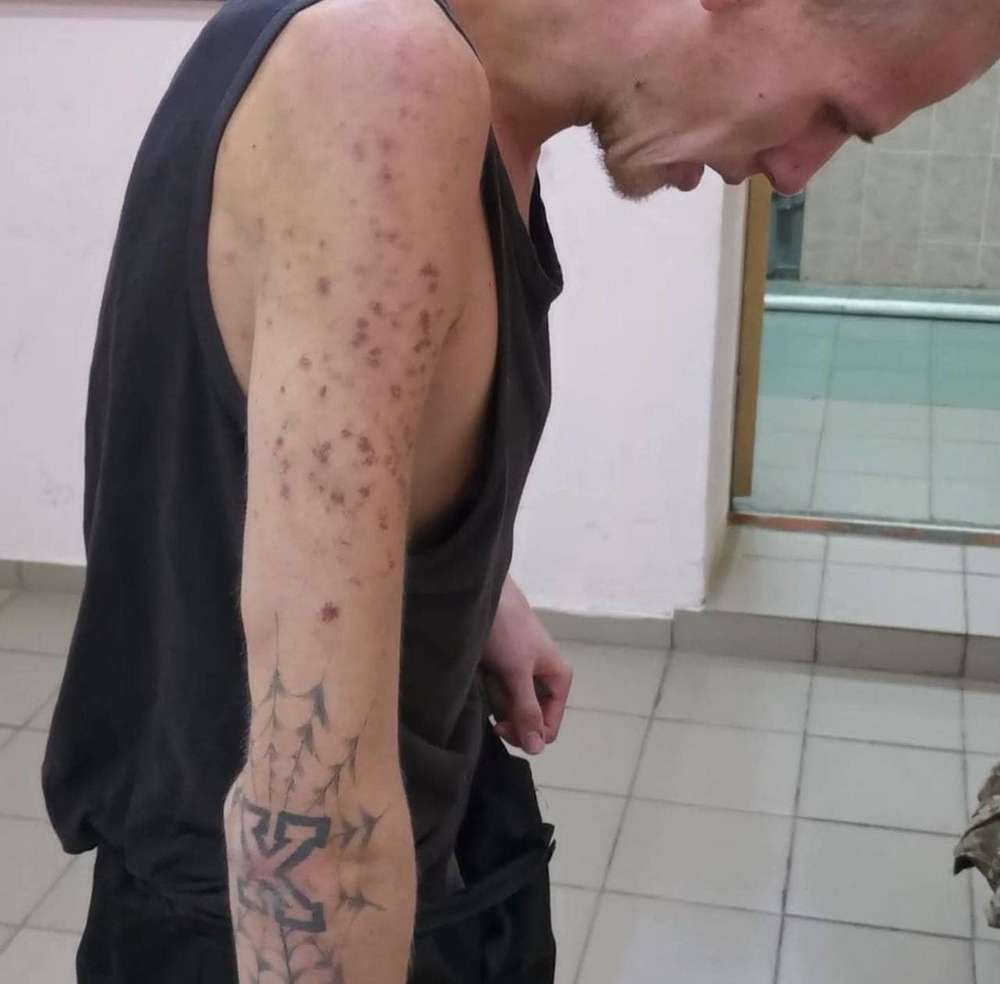 «Полонених катують голодом»: українка показала фото Захисника «Азовсталі», якого у рф засудили до 29 років тюрми