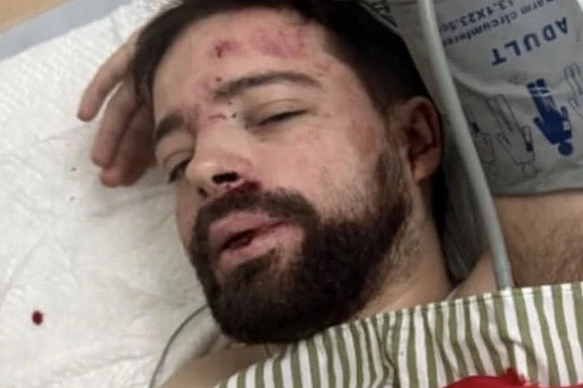 ОНОВЛЕНО: Викладача зі Львова знайшли з проломленим черепом на трасі під Житомиром – що відомо