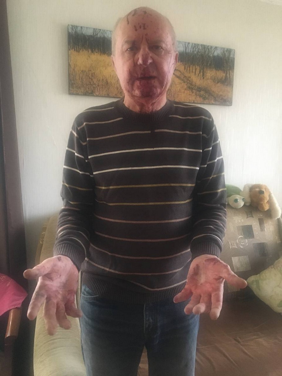 Тягнули двері з обох боків: як підліток і пенсіонер врятували людей з автобусу у Сумах 13 квітня