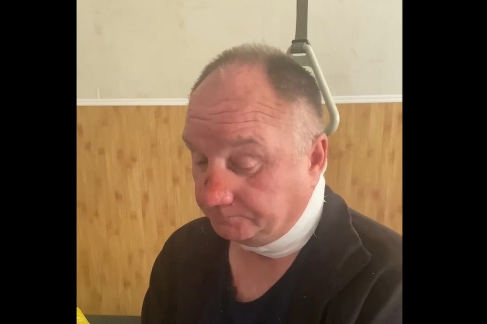 Вибух розірвав її навпіл: поранений водій маршрутки з Білопілля розповів про перші миті після удару 1 Вибух розірвав її навпіл: поранений водій маршрутки з Білопілля розповів про перші миті після удару