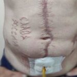 Фото з написом «Слава Росії» на тілі звільненого військового з полону є справжнім, – ГУР