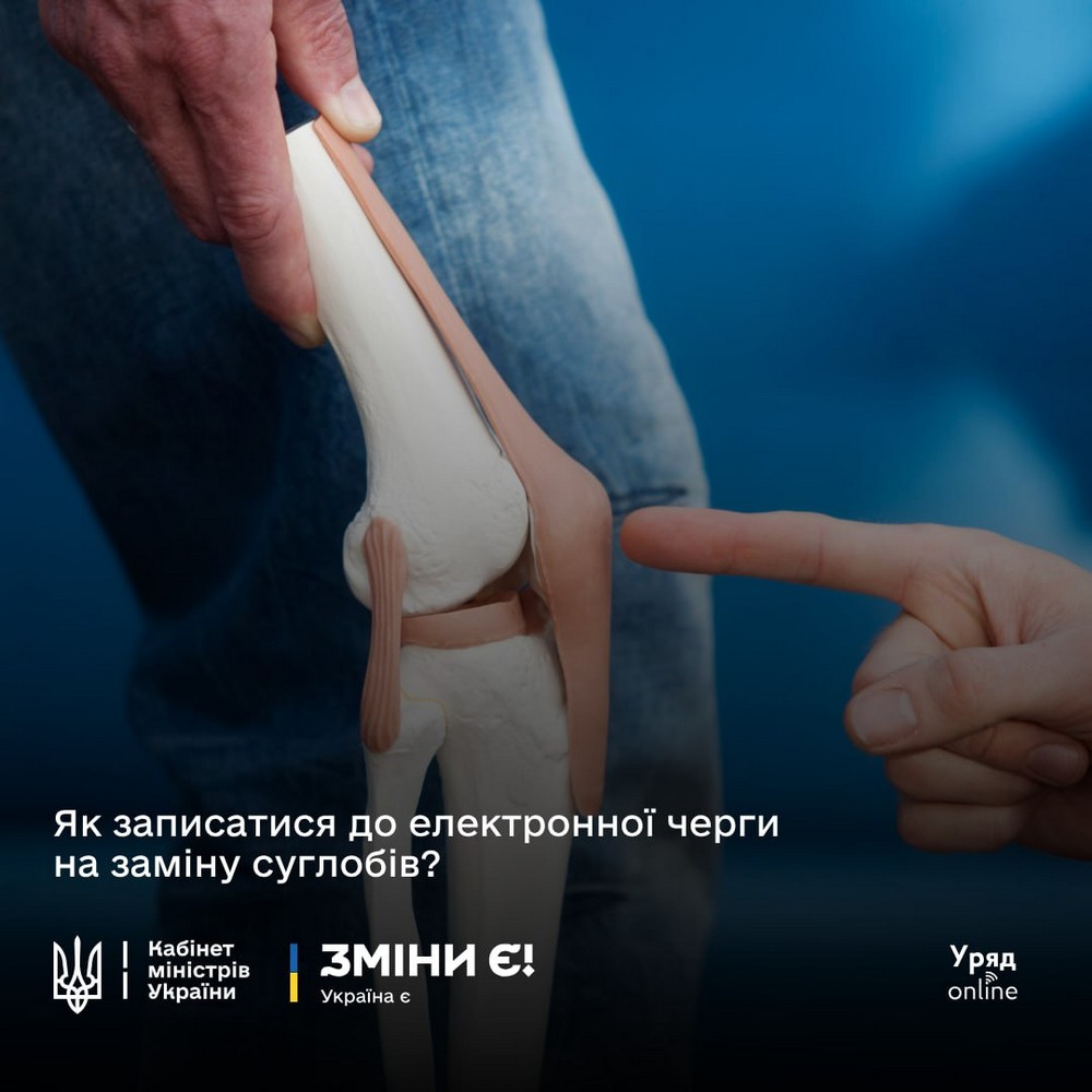 Безоплатне ендопротезування в Україні – де і як отримати послугу