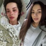 «Лежачи під завалами, чула, як