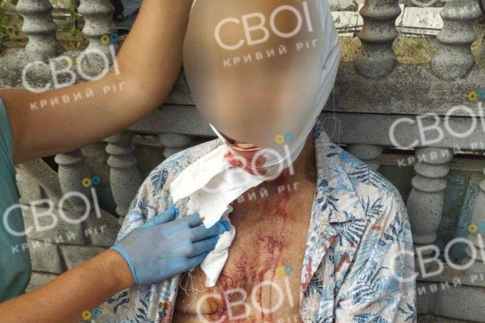 Напав з ножем на жінок, рятувальників, поліцейського і свого батька: на фермі Криворіжжя правоохоронці застрелили 42-річного чоловіка 1 Напав з ножем на жінок, рятувальників, поліцейського і свого батька: на фермі Криворіжжя правоохоронці застрелили 42-річного чоловіка