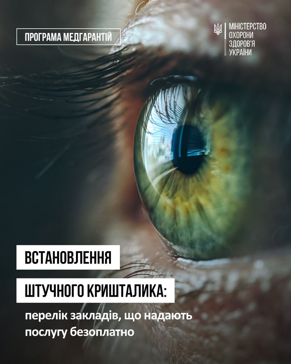 Безкоштовне лікування катаракти у 94 медзакладах України: як отримати послуги