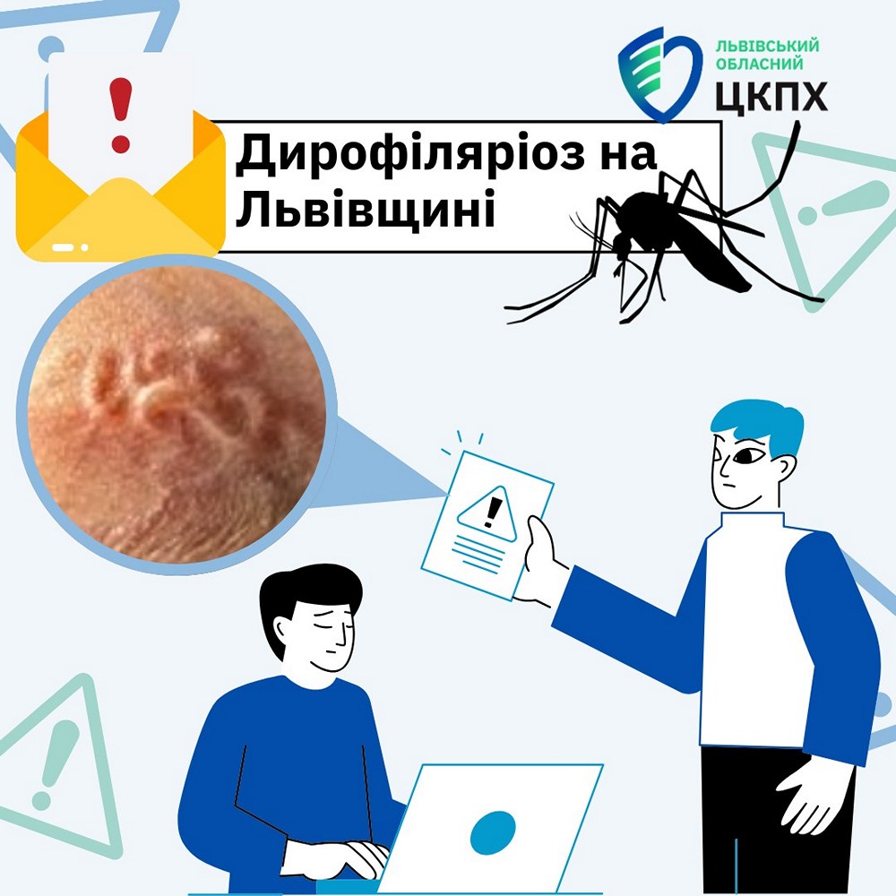 Захворів після укусів комарів - у Львові лікарі видалили з ока чоловіка 12-сантиметрового гельмінта