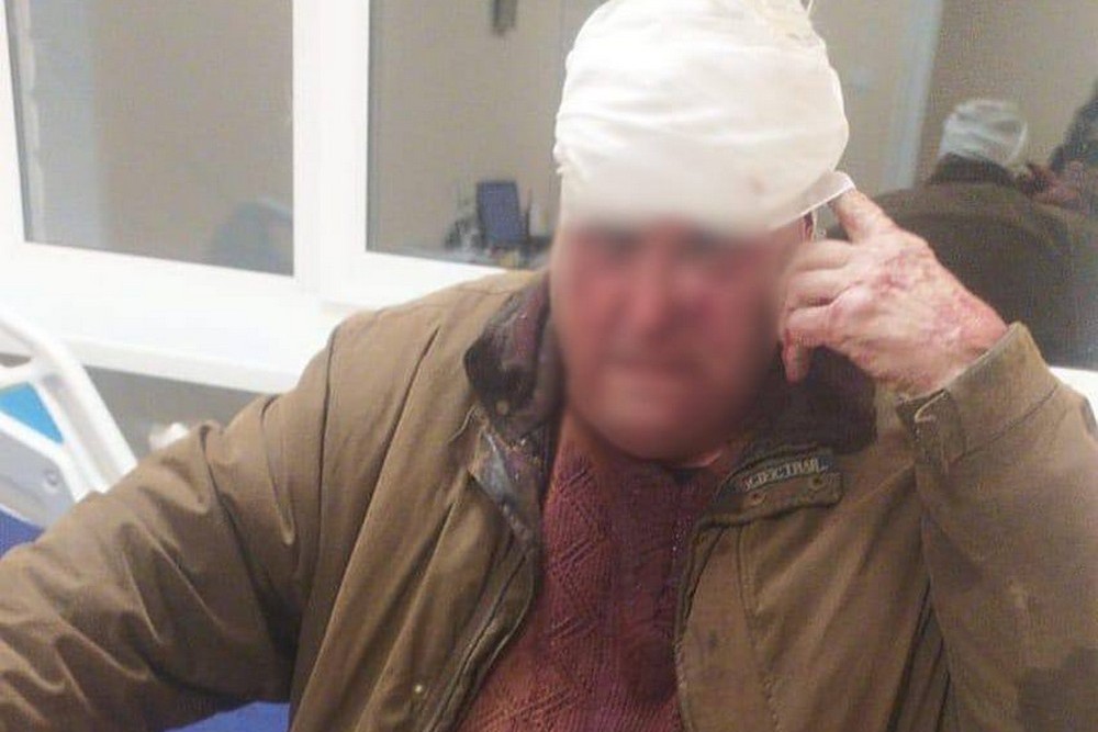 Нічна повітряна атака 5 листопада: удари по енергетиці, є поранені – все, що відомо (фото) 1 Нічна повітряна атака 5 листопада: удари по енергетиці, є поранені – все, що відомо (фото)
