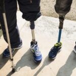 Оновлено перелік високофункціональних протезів для військових і поранених 2