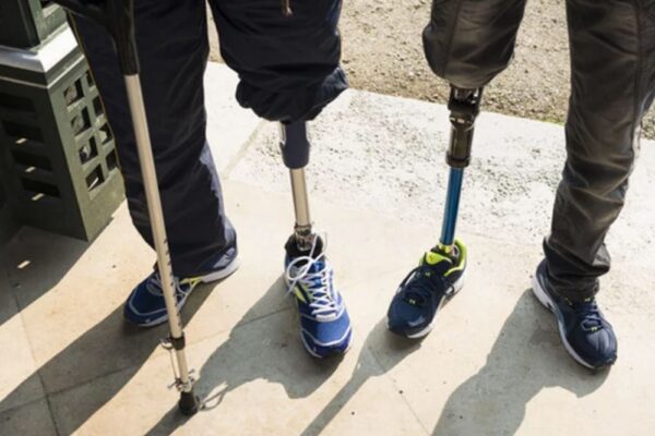 Оновлено перелік високофункціональних протезів для військових і поранених 2