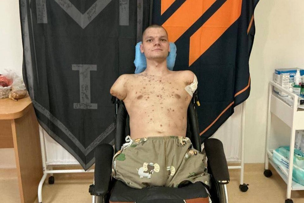 «Я особисто доставлю картку»: голова НБУ відреагував на ситуацію з 20-річним ветераном без рук і ніг, якому не видали картку в ПриватБанку 1 «Я особисто доставлю картку»: голова НБУ відреагував на ситуацію з 20-річним ветераном без рук і ніг, якому не видали картку в Приватбанку