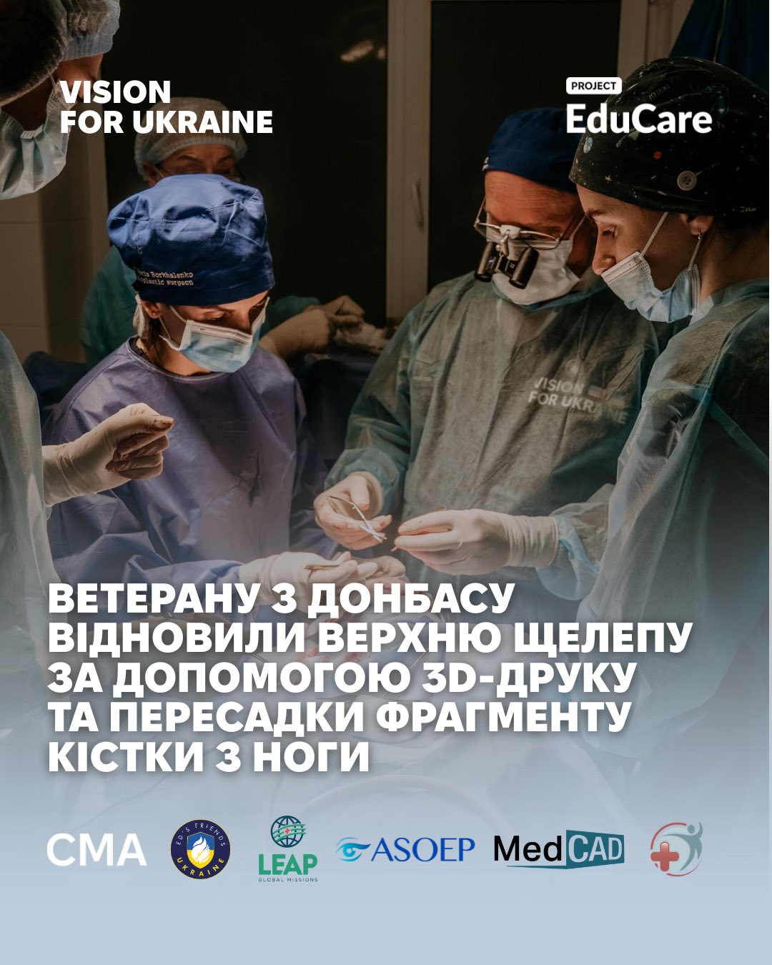 Пораненому військовослужбовцю відновили верхню щелепу за допомогою 3D-друку та пересадки кістки з ноги