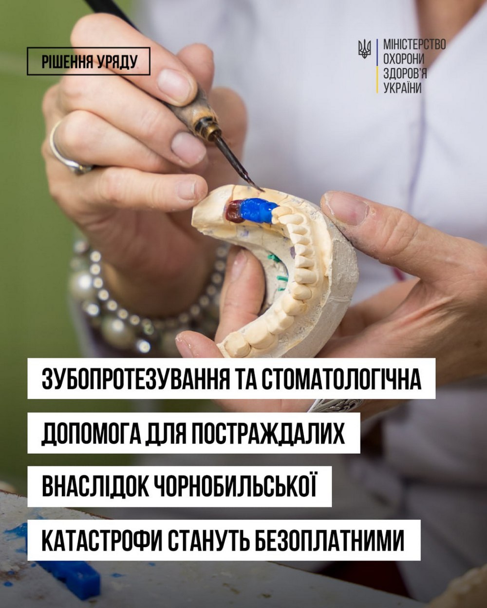 Безкоштовне зубопротезування та стоматологічна допомога для постраждалих на ЧАЕС – Уряд ухвалив рішення