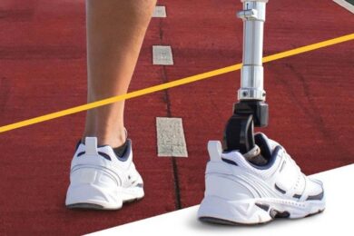 Кожна людина з ампутацією кінцівки має право самостійно обирати підприємство для протезування: куди звертатися