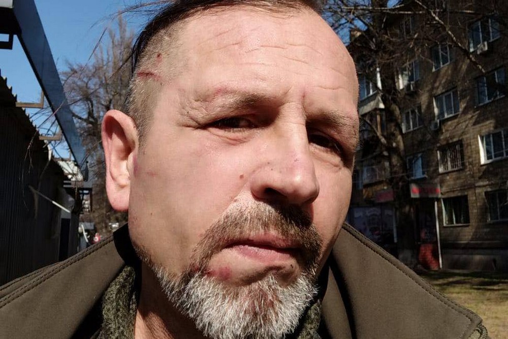 Екс-в’язня Кремля Володимира Балуха побили в ТЦК у Києві – нардеп 1 Екс-в’язня Кремля Володимира Балуха побили в ТЦК у Києві – нардеп