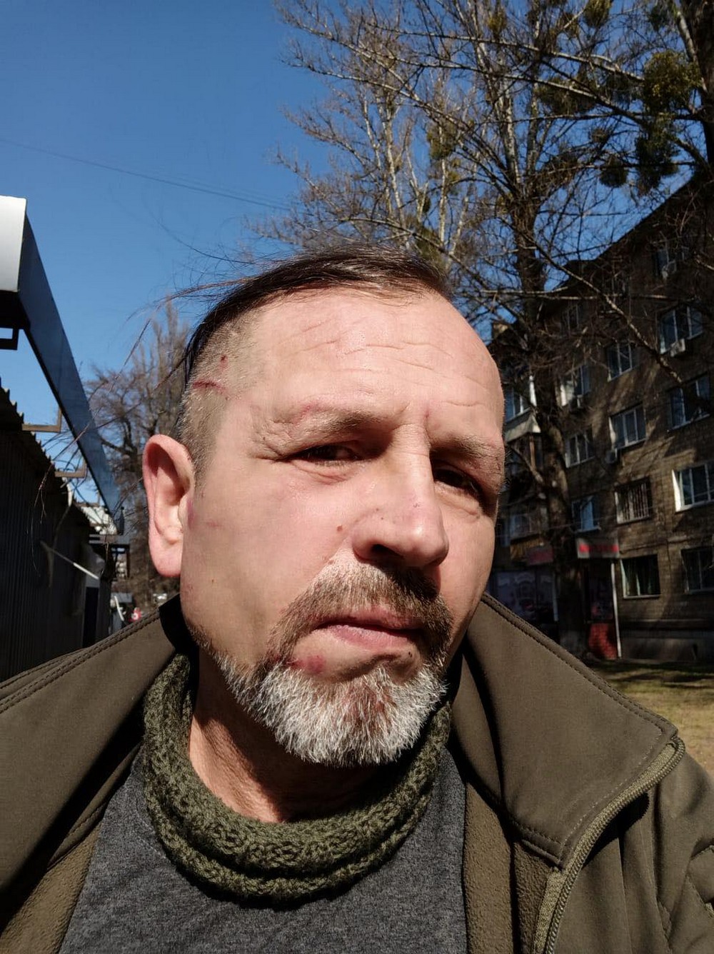 Володимира Балуха побили в ТЦК у Києві: де Володимира Балуха побили в ТЦК у Києві: де