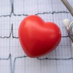 Планове стентування судин серця в Україні тепер безоплатне: як отримати послугу