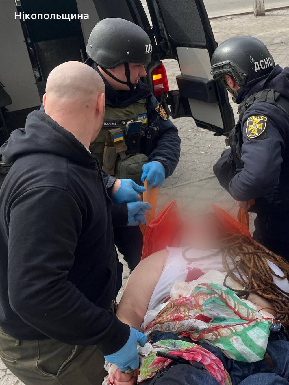 Двоє вбитих і 5 поранених, серед них маленький хлопчик - ворог жорстоко обстрілював Дніпропетровщину сьогодні (фото) Двоє вбитих і 5 поранених, серед них маленький хлопчик - ворог жорстоко обстрілював Дніпропетровщину сьогодні (фото)