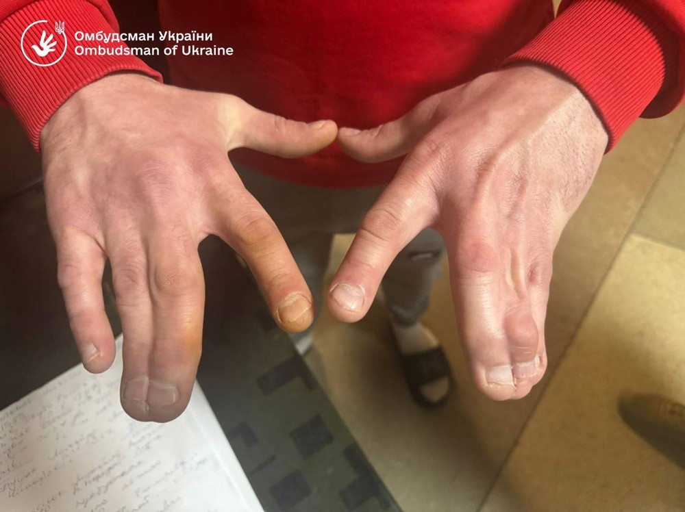 Незаконне утримання, антисанітарія та ігнорування хвороб: перевірили один із ТЦК в Україні (фото, відео) Незаконне утримання, антисанітарія та ігнорування хвороб: перевірили один із ТЦК в Україні (фото, відео)