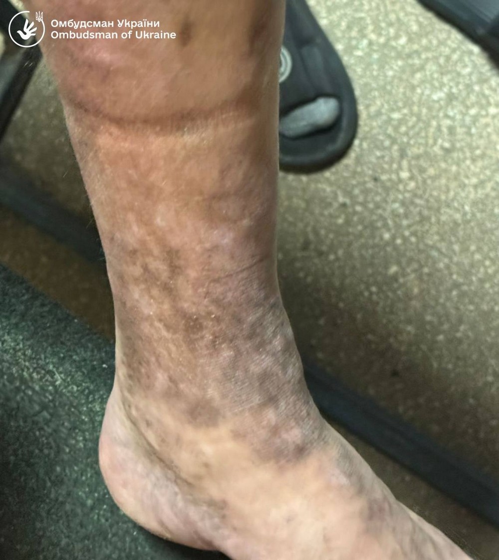 Незаконне утримання, антисанітарія та ігнорування хвороб: перевірили один із ТЦК в Україні (фото, відео) Незаконне утримання, антисанітарія та ігнорування хвороб: перевірили один із ТЦК в Україні (фото, відео)