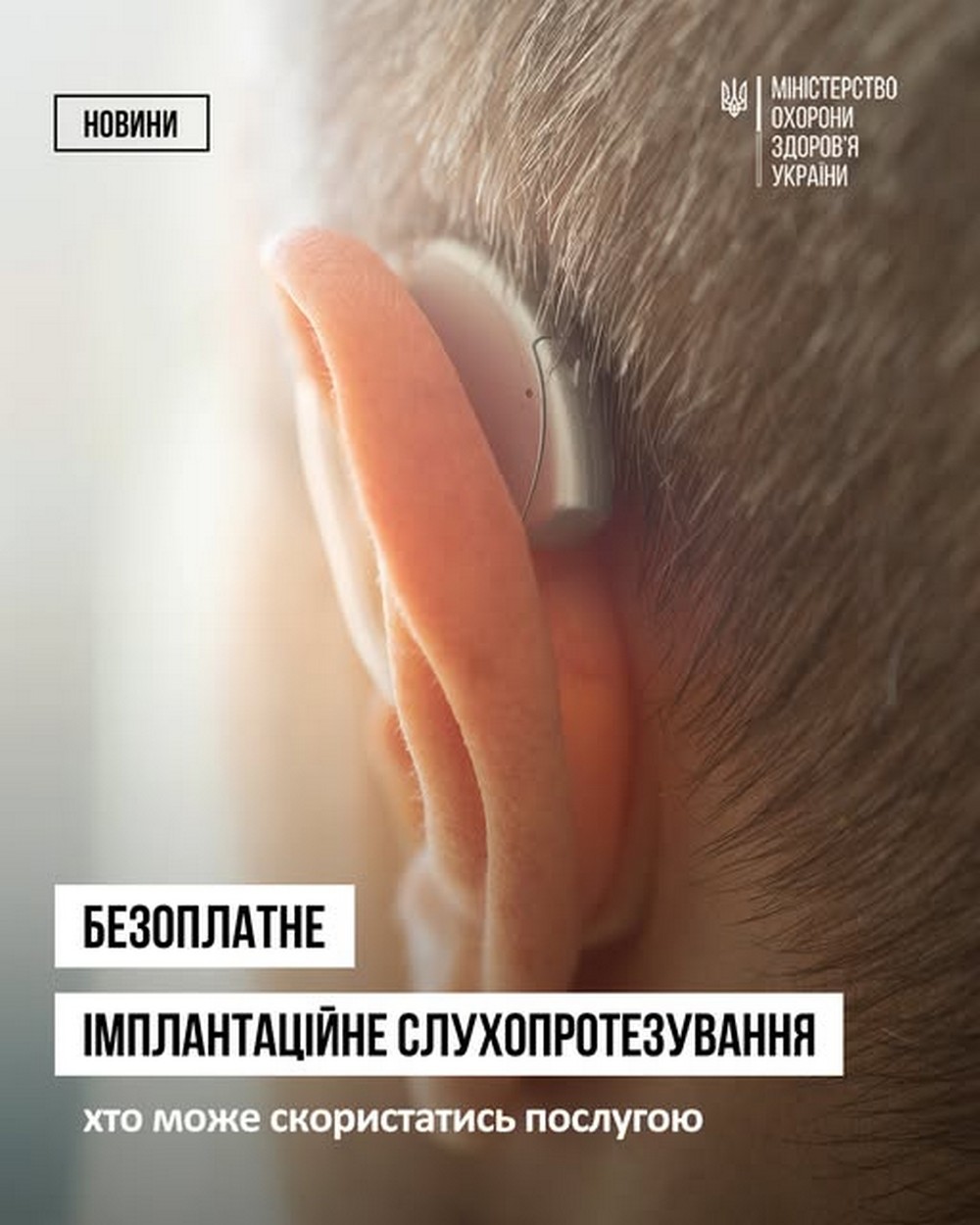 Розширено коло людей, які мвють право на безкоштовні операції з імплантаційного слухопротезування