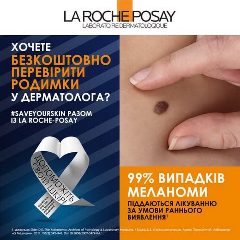 Можна безкоштовно перевірити родимки у дерматолога: перелік міст і контакти