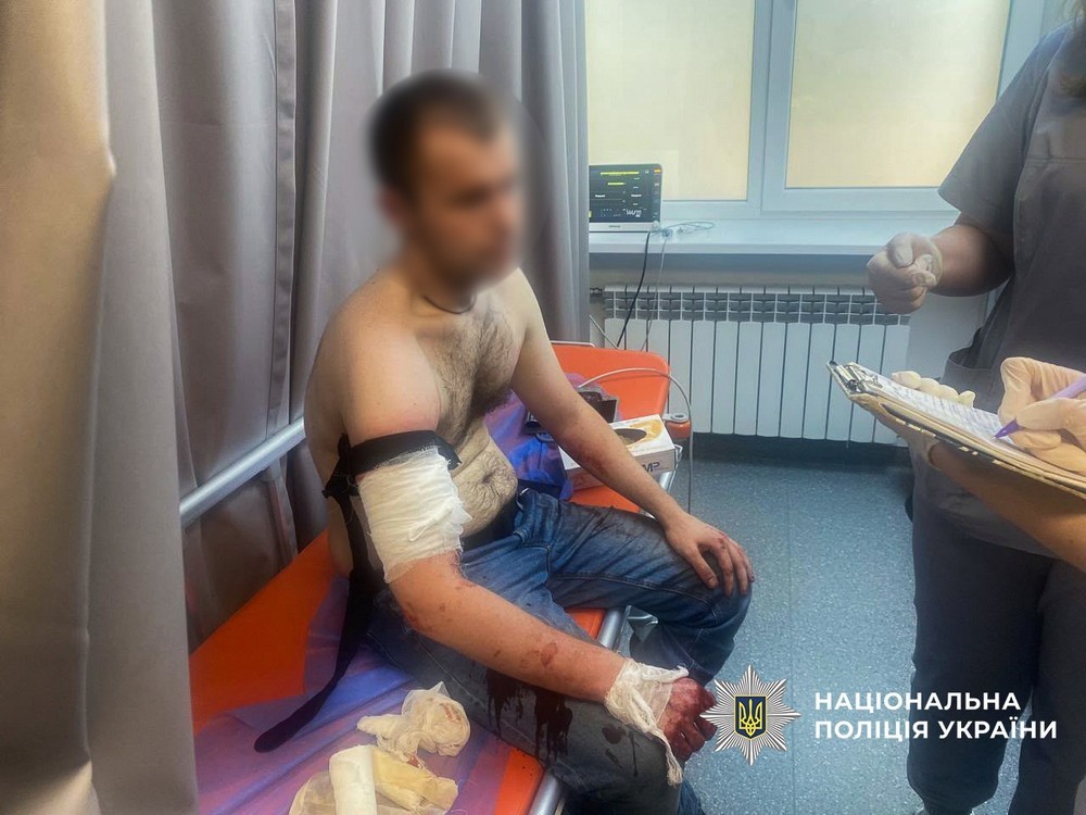 Чоловік підрізав трьох поліцейських у Запоріжжі сьогодні. Нападника було ліквідовано.