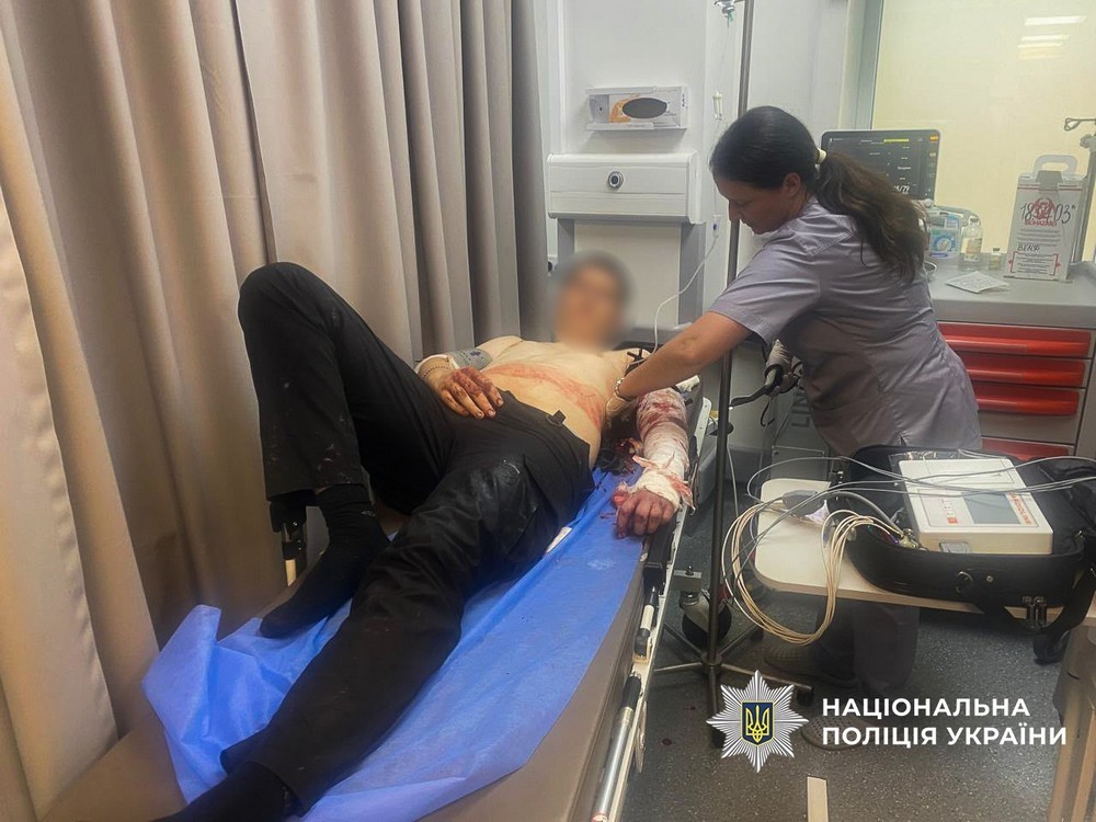 Чоловік підрізав трьох поліцейських у Запоріжжі – його застрелили (фото)