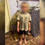Струс мозку, множинні гематоми та садна у дитини – на Одещині матір підозрюють у катуванні 5-річного сина