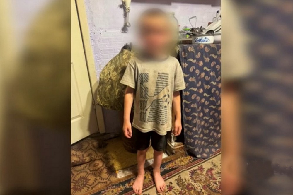 Струс мозку, множинні гематоми та садна у дитини - на Одещині матір підозрюють у катуванні 5-річного сина