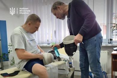 Безкоштовне протезування: Уряд покращує умови – що відомо